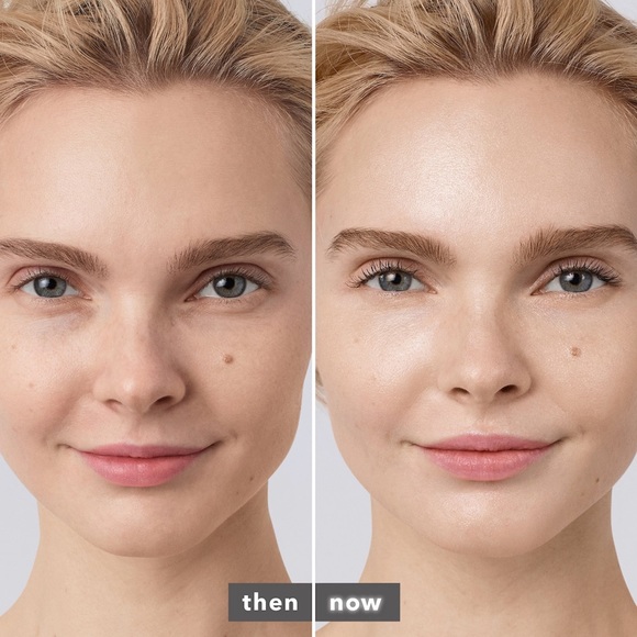 🔴FLASH SALE🔴Backlight Priming Filter Travel - Picture 5 of 7